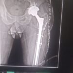 IMG-20240127-WA0017(1)